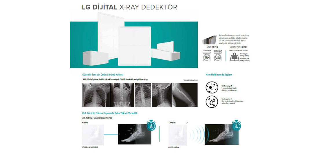 DİJİTAL X-RAY DEDEKTÖRLER